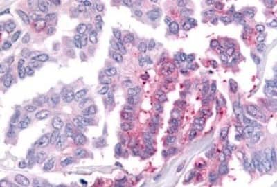 Immunohistochemistry: WNK1 Antibody [NBP3-14518]